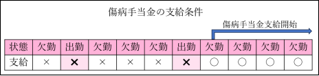傷病手当金